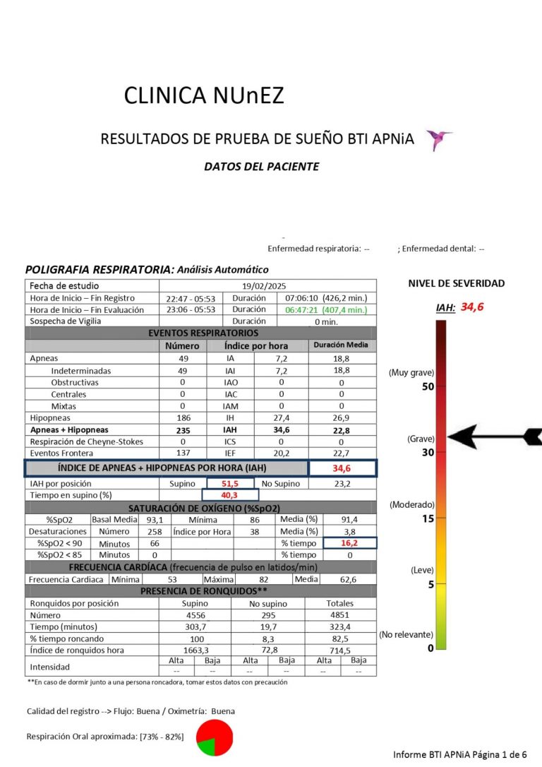 Apnea del sueño es grave