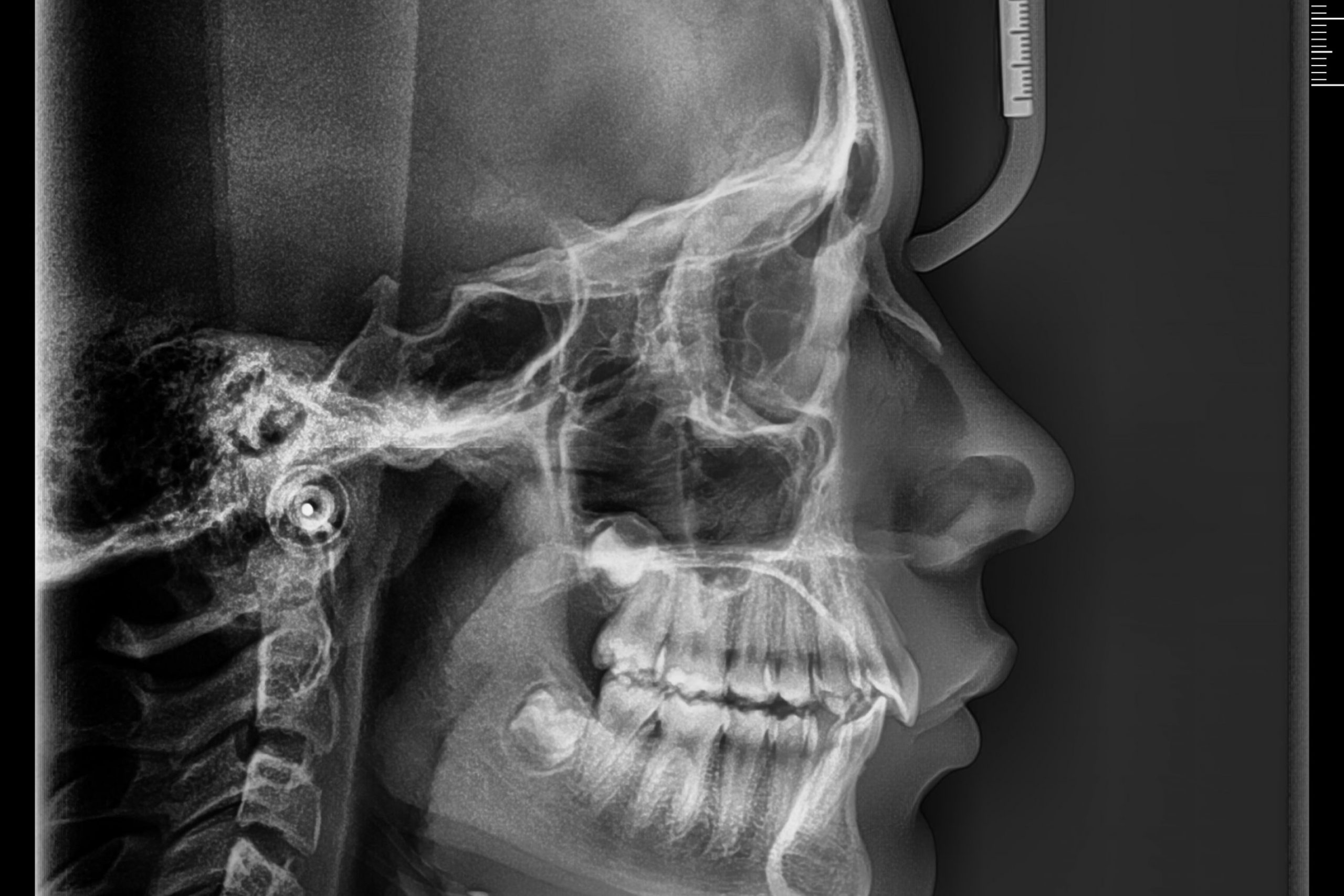 Ortodoncia en Sevilla